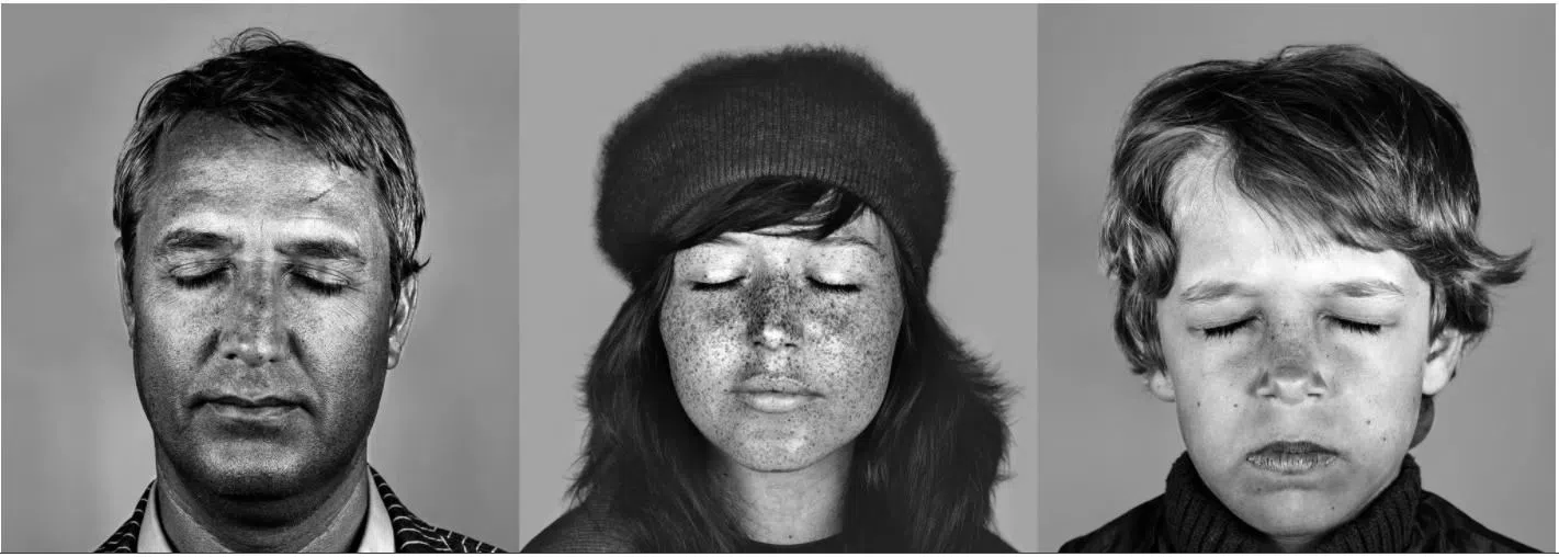 Why can uv light hurt people？What to do if injured by UV light？ Pixel